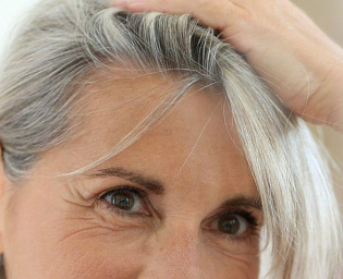  Врач посоветовала способ борьбы с сединой