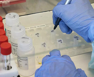  Главный уролог Минздрава РФ заявил, что коронавирус передается половым путем